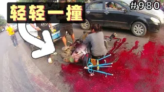 小伙开车轻轻一撞，大妈爆出一地鲜血！求司机心理阴影面积【980期】