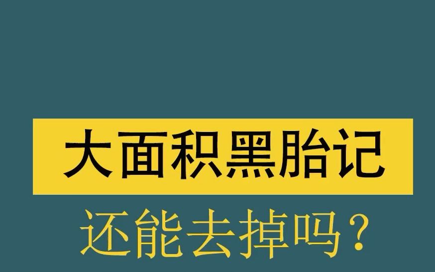 大面积黑胎记还能去掉吗?哔哩哔哩bilibili