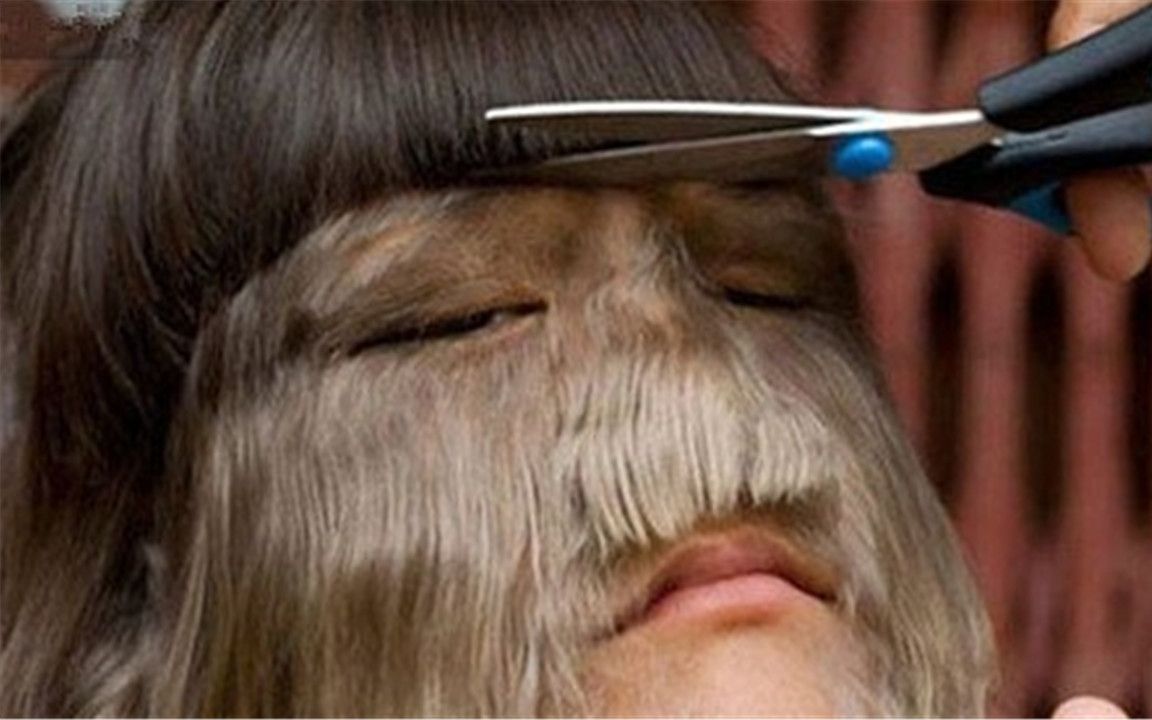世界上体毛最长的人毛发覆盖率96剃光毛后竟然是个美女