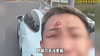 Download Video: 抵押车终结者给清收队放大招了！