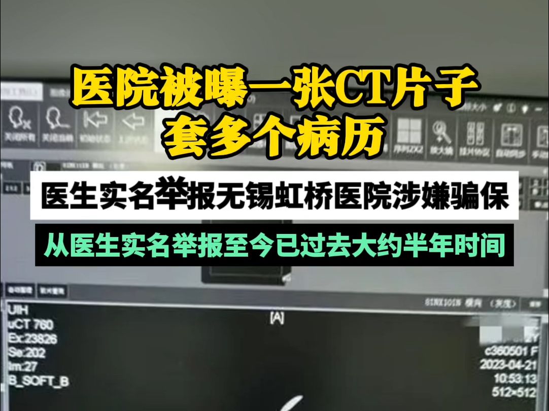 医院被曝一张CT片子套多个病历 医生实名举报无锡虹桥医院涉嫌骗保哔哩哔哩bilibili