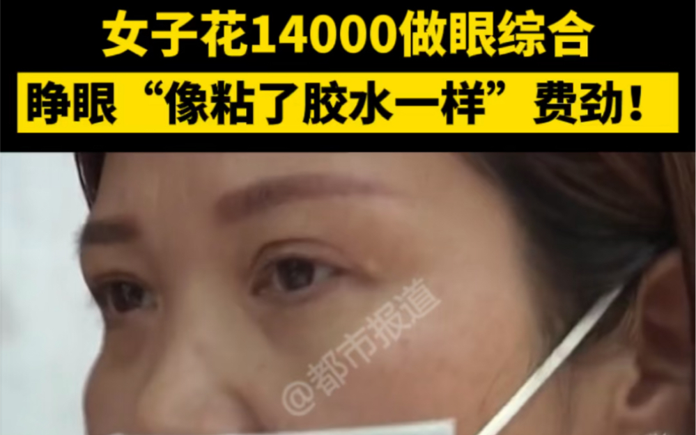 都市报道【女子花14000做眼综合 睁眼“像粘了胶水一样”费劲!】哔哩哔哩bilibili