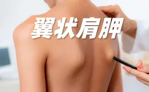 Télécharger la video: 翼状肩胛多是这2种情况！试试这样改善