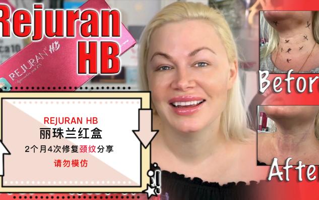 高手玩转丽珠兰童颜红盒Rejuran HB使用方法分享哔哩哔哩bilibili