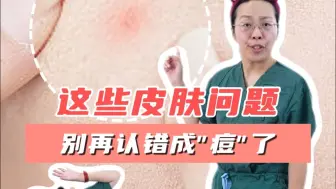 什么是痘痘？什么是火疖子？
