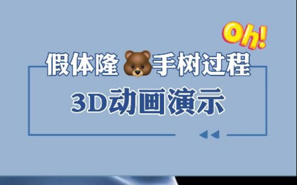 3D动画演示:假体丰胸手术过程!哔哩哔哩bilibili