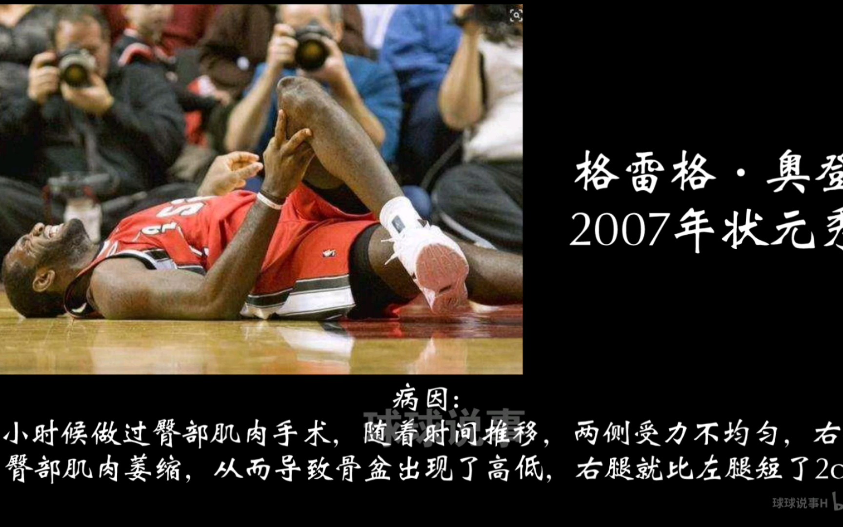 盘点NBA历史上那些玻璃人体质球员的病因哔哩哔哩bilibili