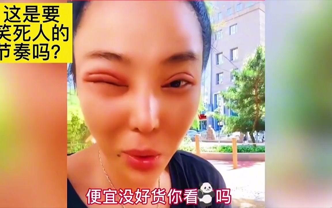 全网那些整容失败的案例,身体发肤受之父母,要接受不完美的自己哔哩哔哩bilibili