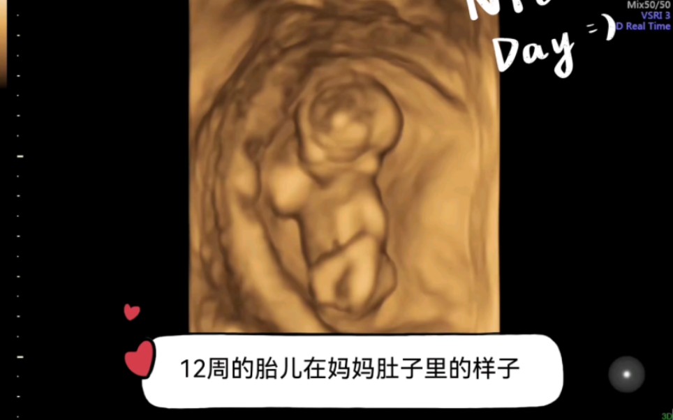 12周胎儿姿势图片