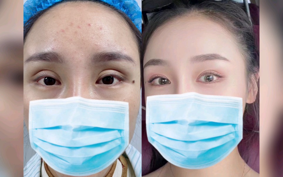 假大宽深双眼皮有多显老?你从眼睛能看出她多少岁吗?