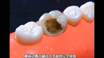 下载视频: 根管治疗全过程