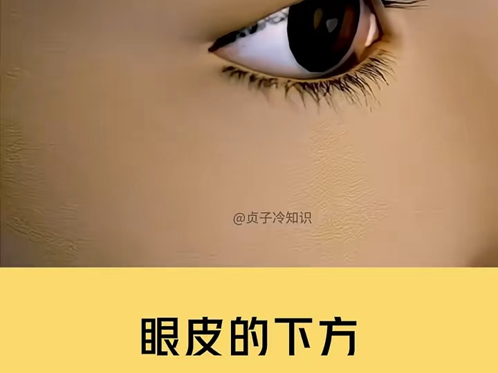 黑眼圈熊猫眼很常见,但白眼圈怎么回事?哔哩哔哩bilibili