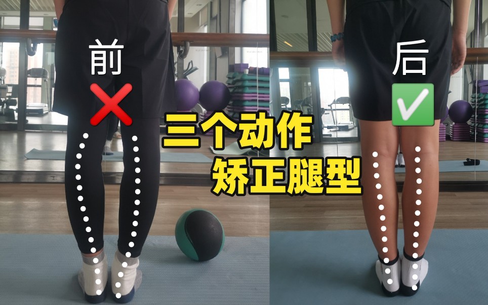 3个动作【矫正腿型教程】赶紧试试吧
