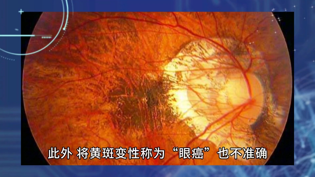 恐怖!手机看的多会得眼癌?