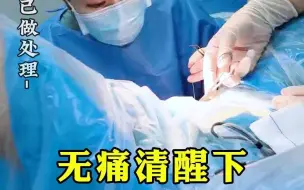 Descargar video: 无痛清醒下小樱唇整形