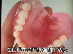 Download Video: 单颗牙缺失种植的优势