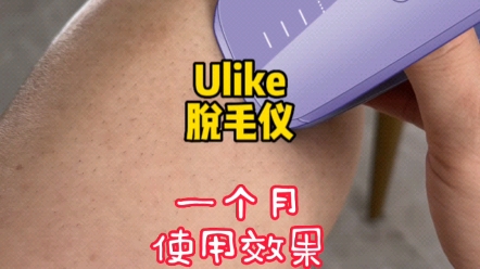 4周使用测评Ulike脱毛效果真的很……哔哩哔哩bilibili