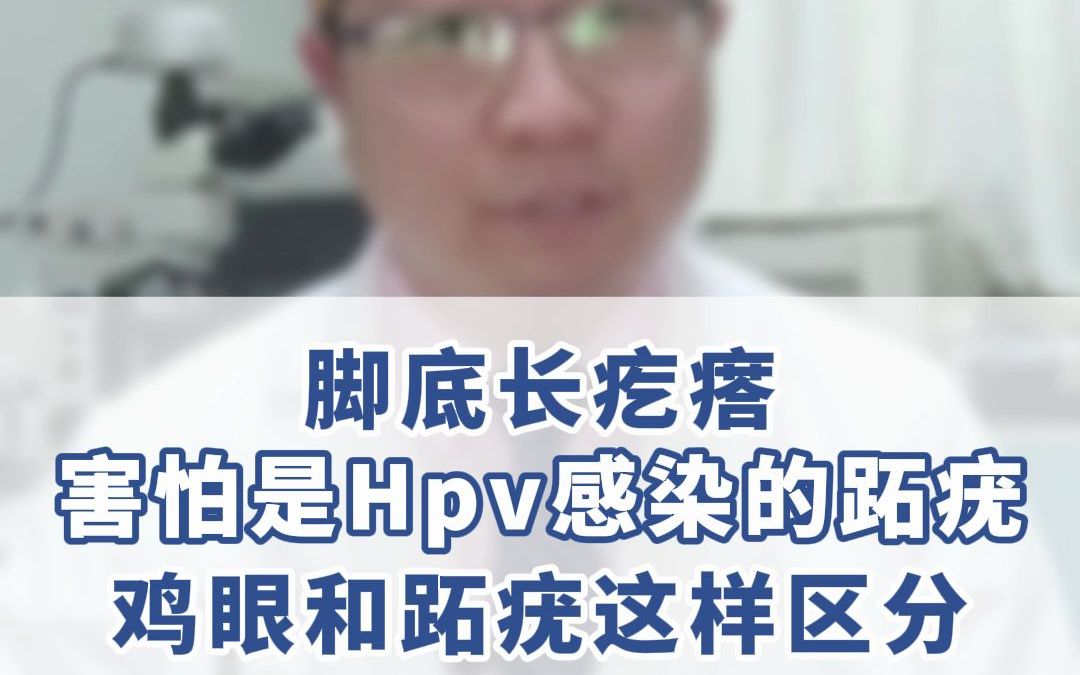 4脚底长疙瘩,害怕是hpv感染的跖疣,鸡眼和跖疣这样区分dy哔哩哔哩bilibili