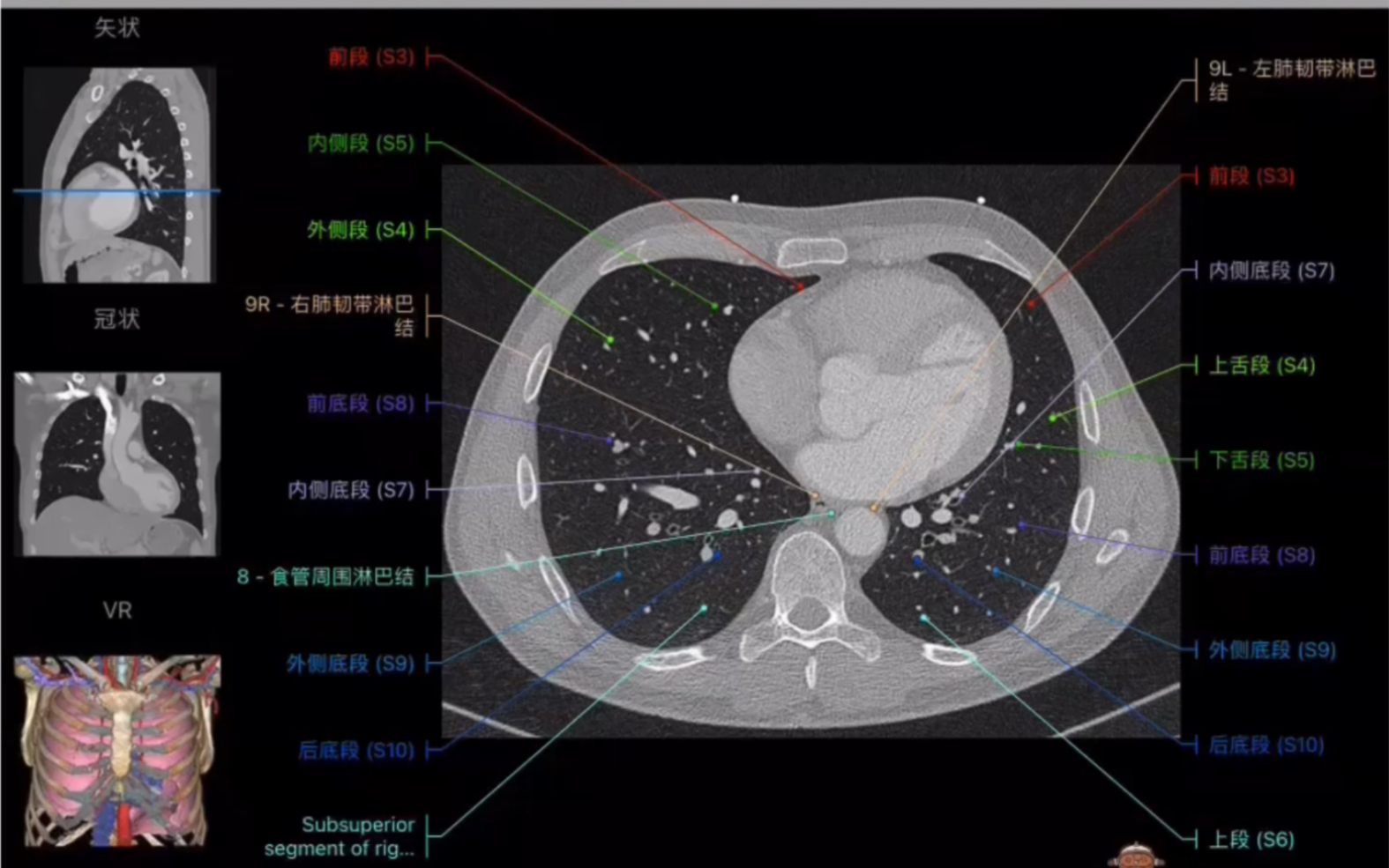 [图]推荐一个超好用的e-anatomy中文版断层影像解剖图谱