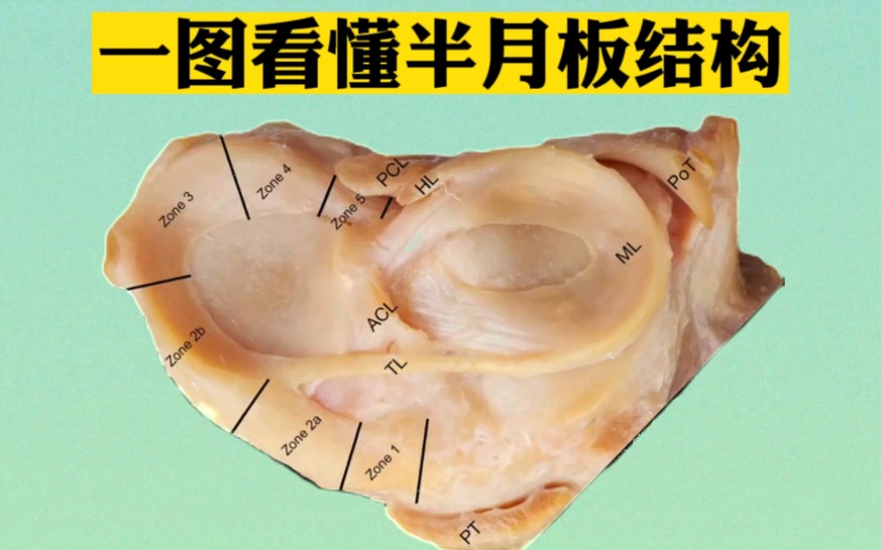 一圖看懂半月板結構