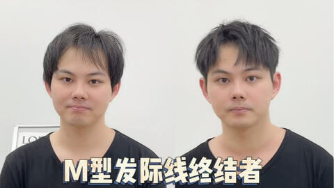 男生头发细软 发量稀少适合什么发型 看完你就知道了 哔哩哔哩 男生头发细软 发量稀少适合什么发型 看完你就知道了 哔哩哔哩