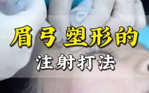 Download Video: 眉弓塑形注射打法讲解