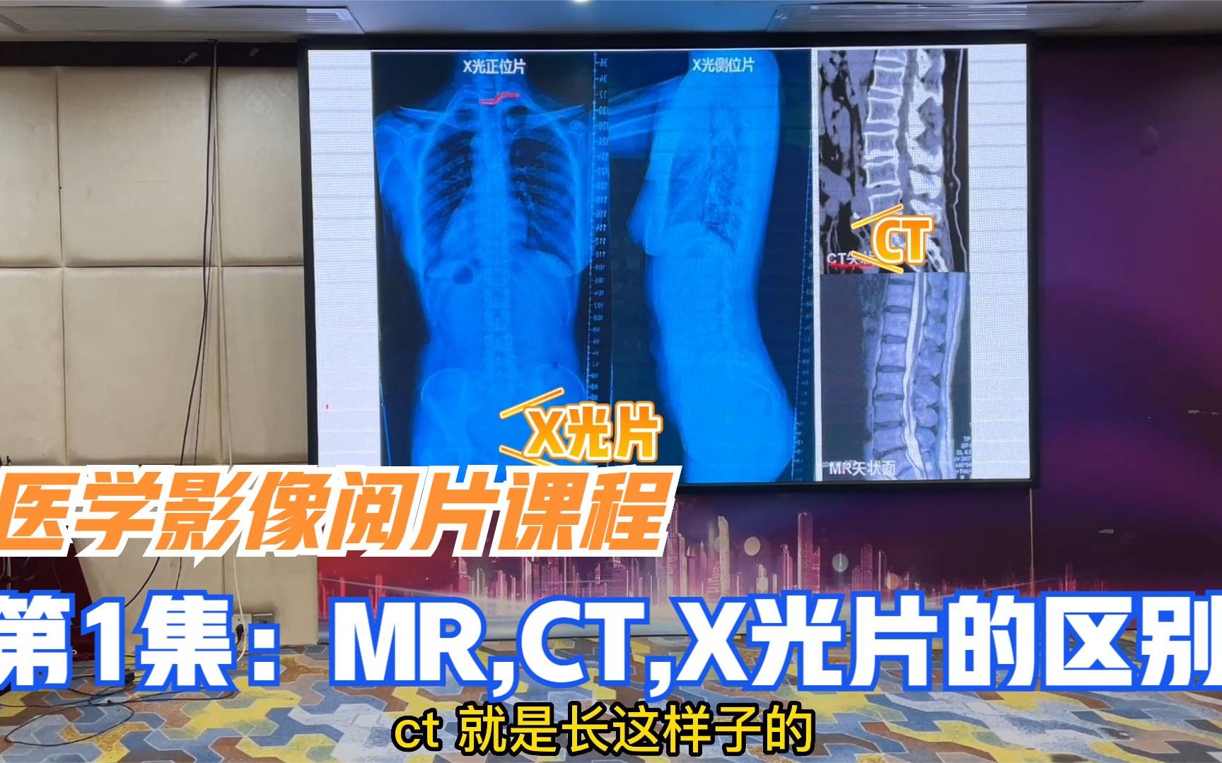 [图]如何看懂医学影像片？从基础学起，一个表格看懂MR，CT，X光区别