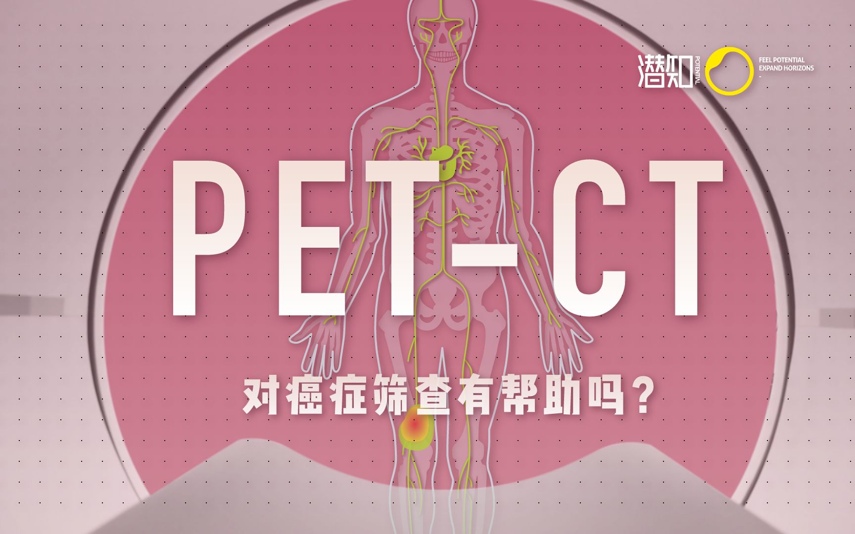 「健康科普」体检的误区和骗局:PETCT 是什么?对癌症筛查真的有帮助吗?哔哩哔哩bilibili