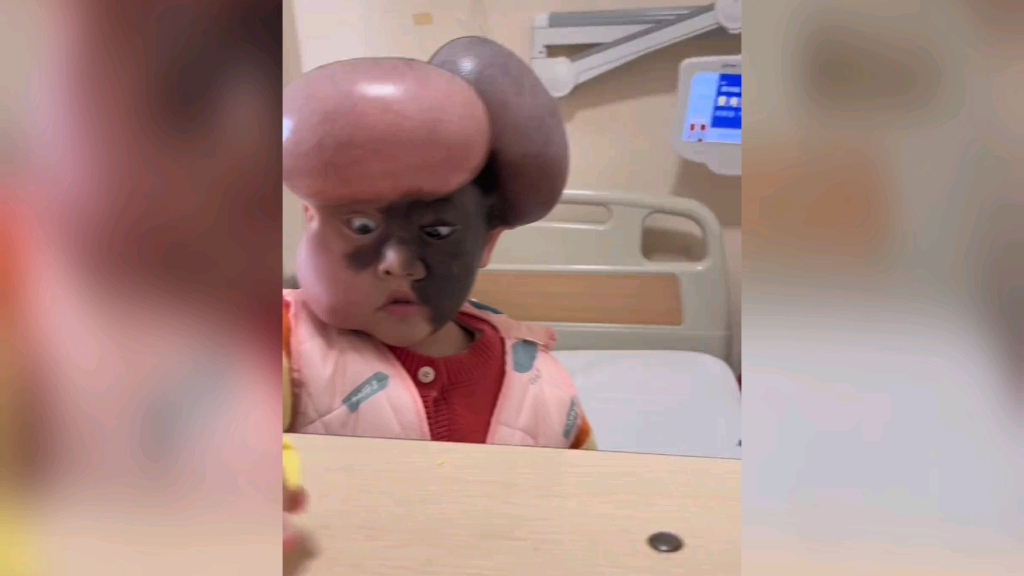 三岁女童脸长兽皮痣 妈妈拍女儿日常视频却遭网友质疑 是对是错?