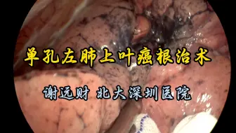 单孔胸腔镜左肺上叶癌根治术 1.4倍速 谢远财（北大深圳医院）