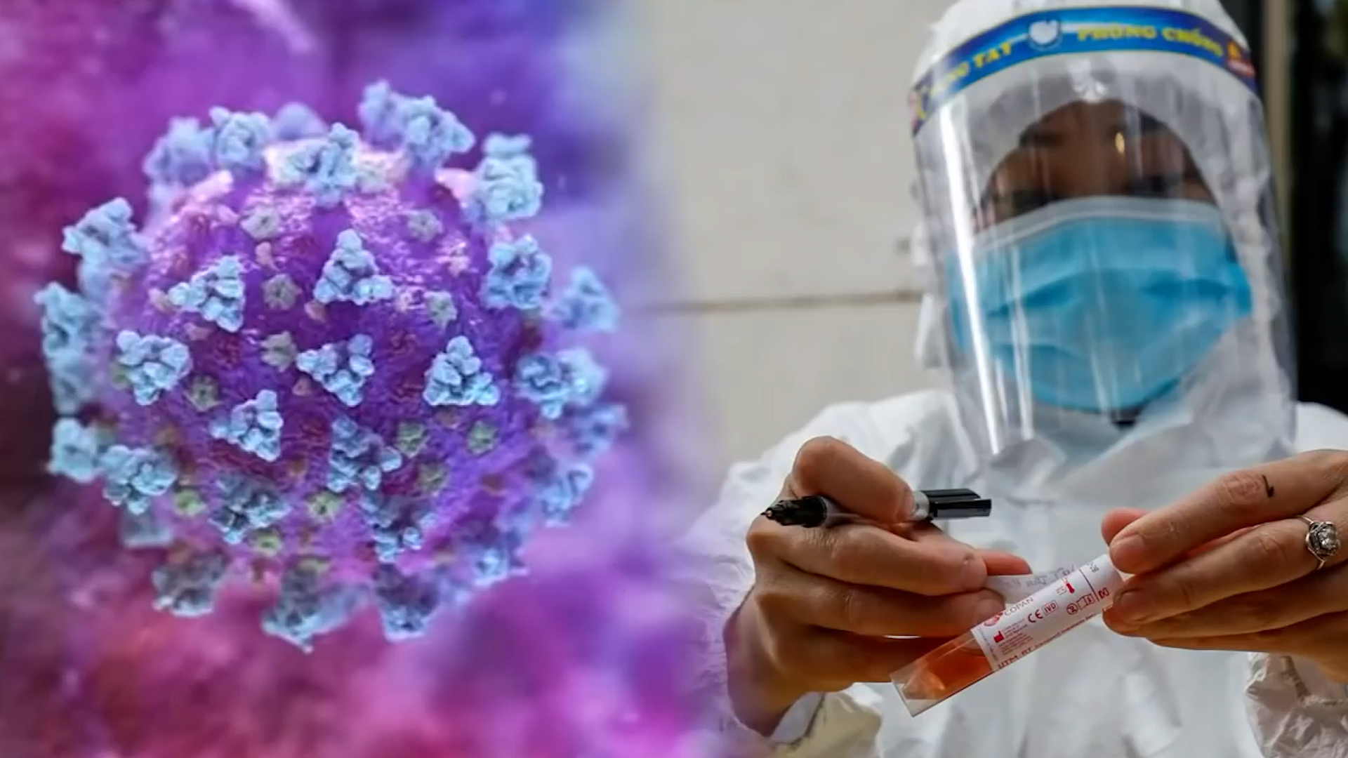 越南:发现新冠变种病毒混合体!