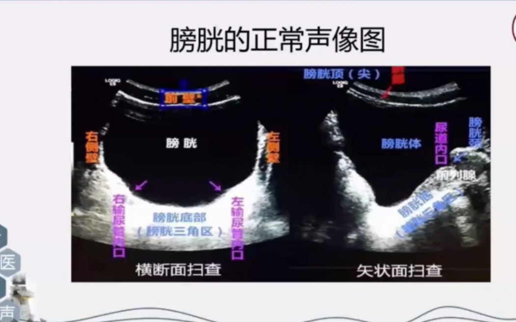 [图]超声诊断学:泌尿超声解剖及规范化超声检查手法