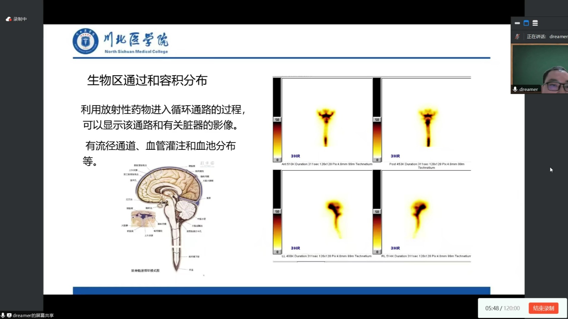 24.9.10核医学02哔哩哔哩bilibili