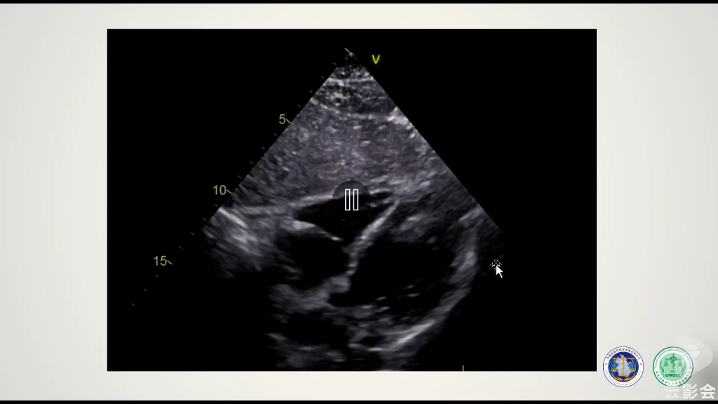 [图]心脏超声操作（18分钟左右后为真人上机操作，全套课程共47集）