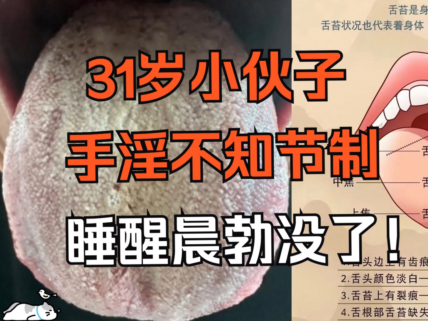 31岁小伙子,手淫不知节制,睡醒晨勃没了!