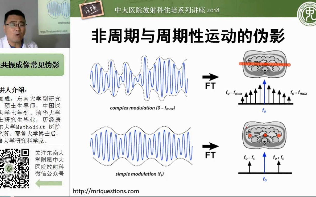 磁共振成像常见伪影中大刘加成哔哩哔哩bilibili