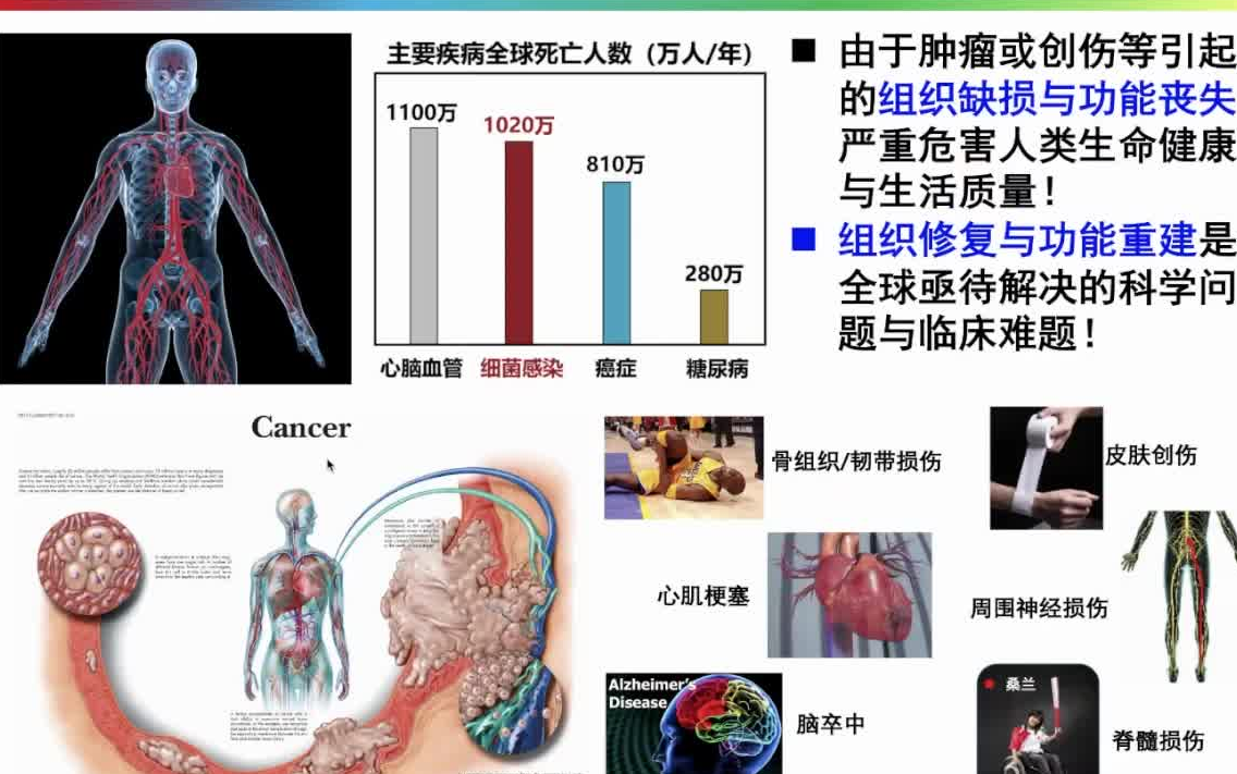 20220820北京化工大学薛佳佳静电纺丝弹性纤维用于组织损伤修复哔哩哔哩bilibili