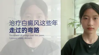 治疗白癜风这些年，走过的弯路。
