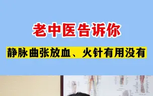 老中医告诉你静脉曲张放血、火针有用没有