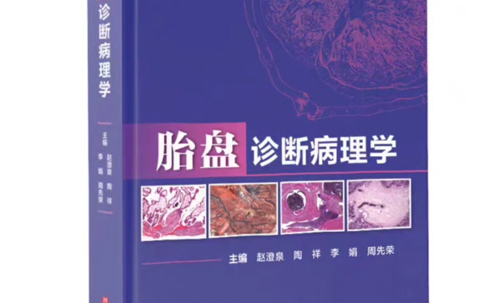 【PDF】胎盘诊断病理学高清彩图哔哩哔哩bilibili