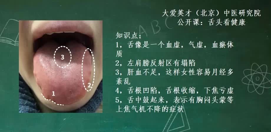 舌象分析血虛氣虛血瘀相對比較難懷孕的舌象講解