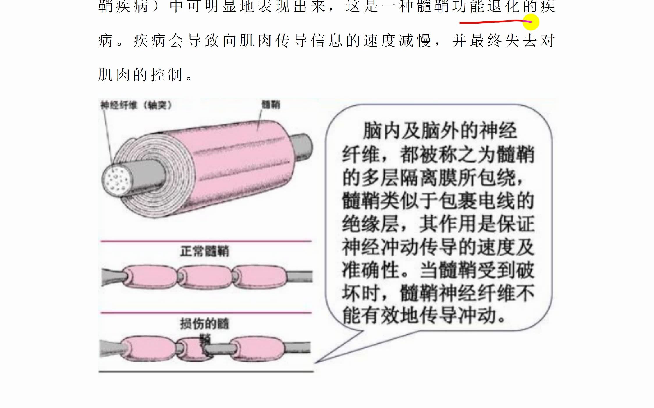 髓鞘及其结构和功能哔哩哔哩bilibili