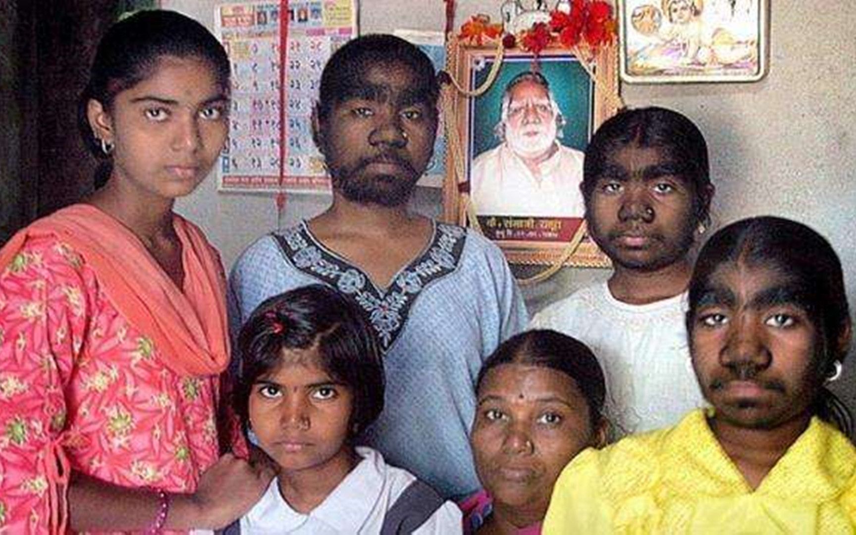 没血缘关系的人会有相似的长相吗全村230人长得一模一样太诡异