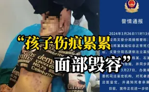 Tải video: 5岁男童疑被生母和其男友虐待致死“面部毁容，耳内有血”当地警方:已立案侦查