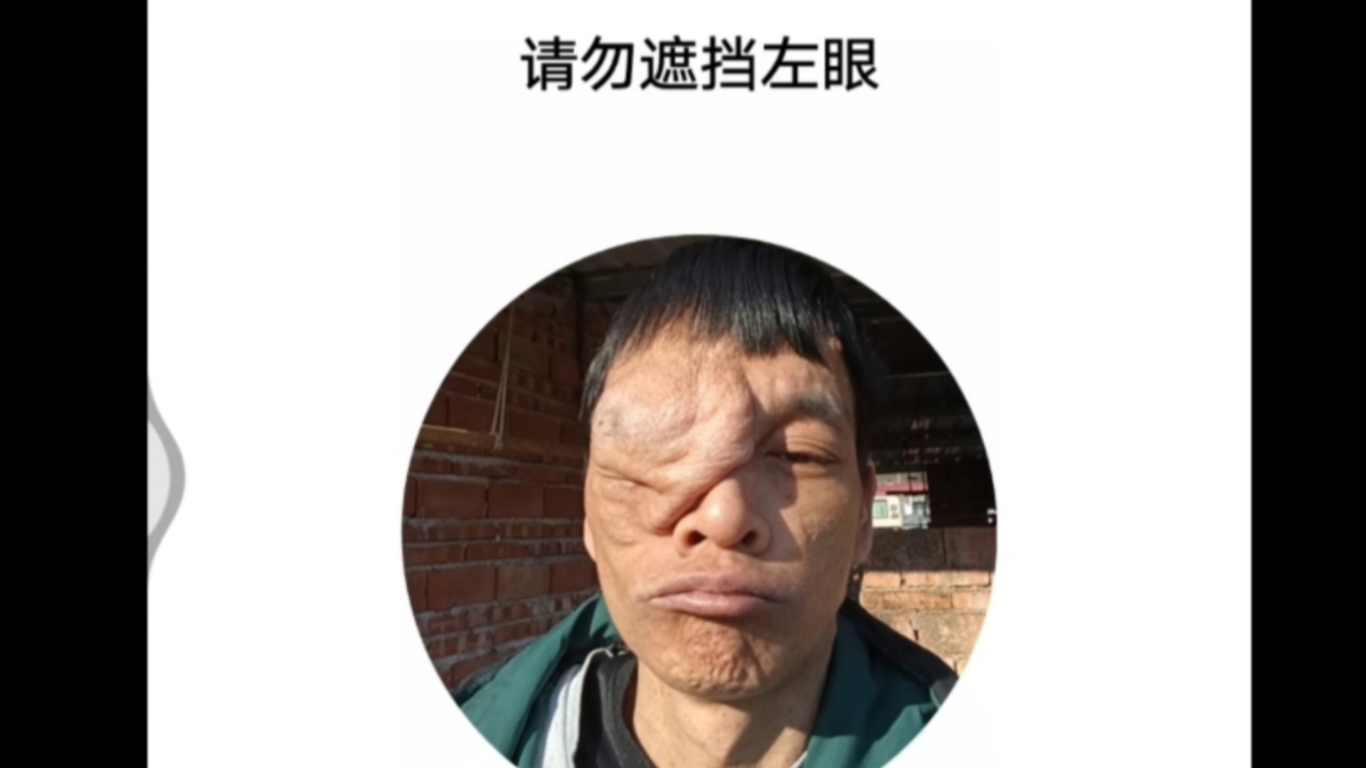 别蚌着了,笑一笑!我要流量做手术!哔哩哔哩bilibili