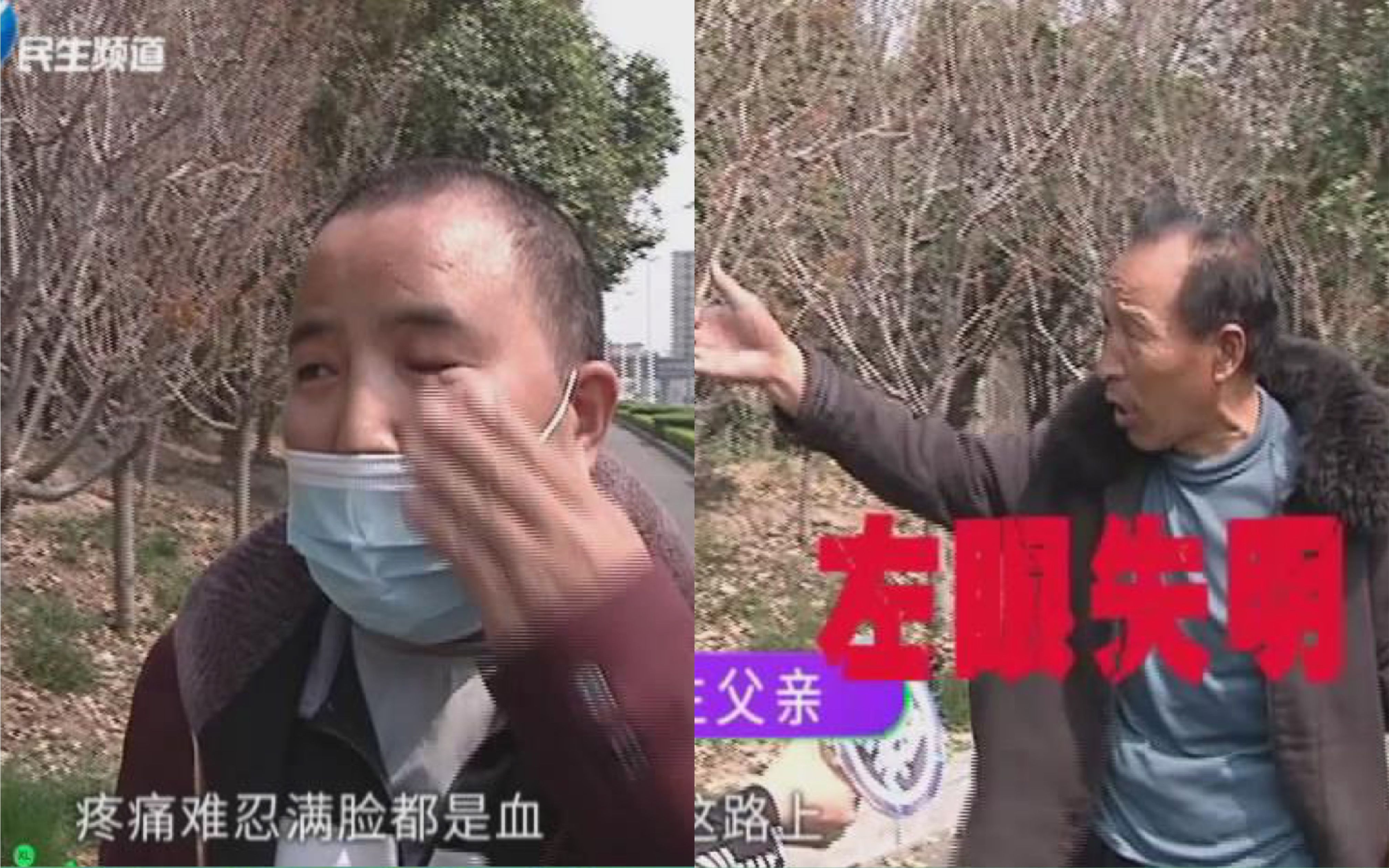 男子走路上忽然眼睛被戳瞎太嚇人了