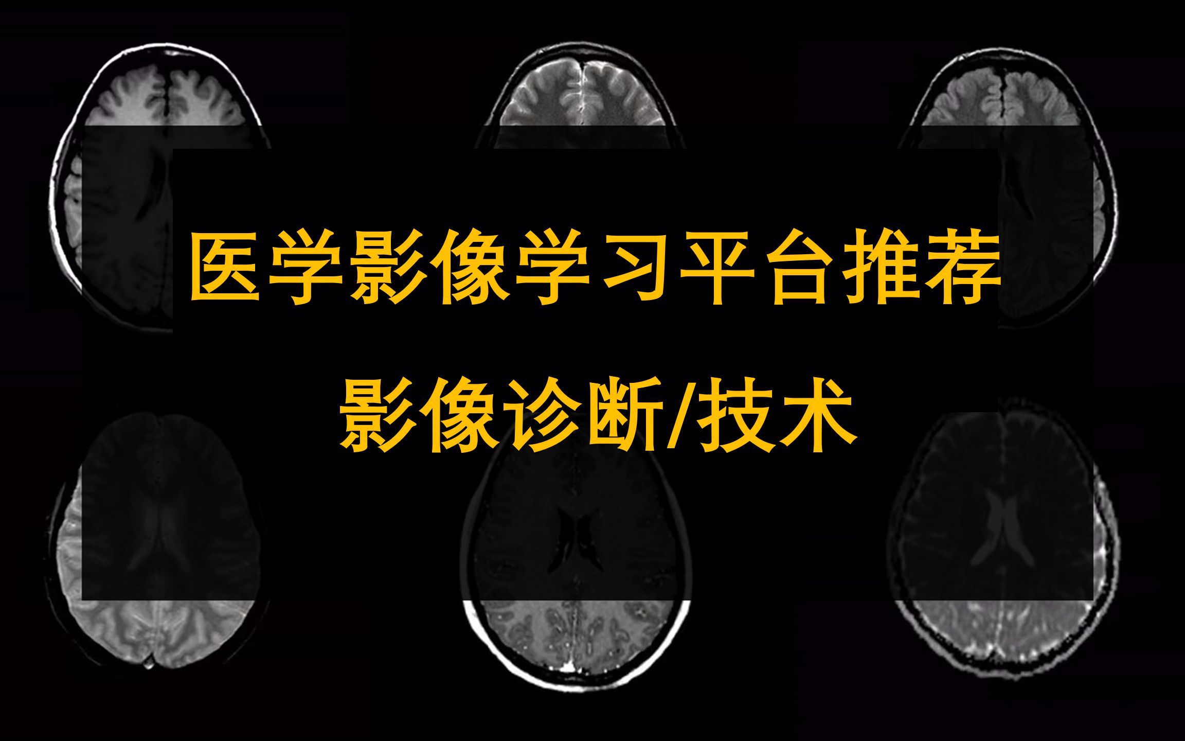 [图]医学影像学习平台看这个视频就够了，影像初学者必看！