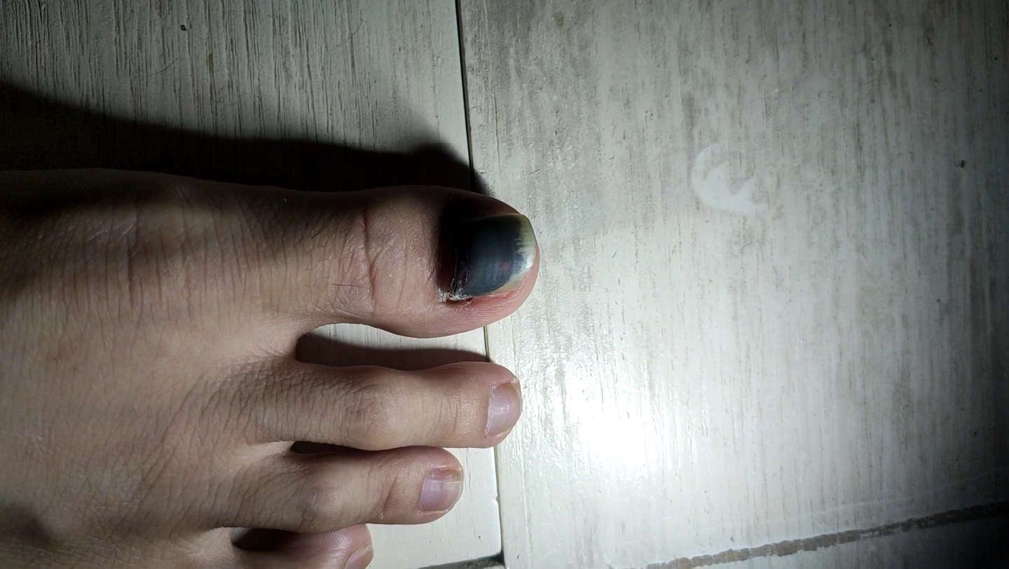 活动作品黑子甲