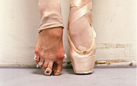 跳芭蕾舞的脚受损图片