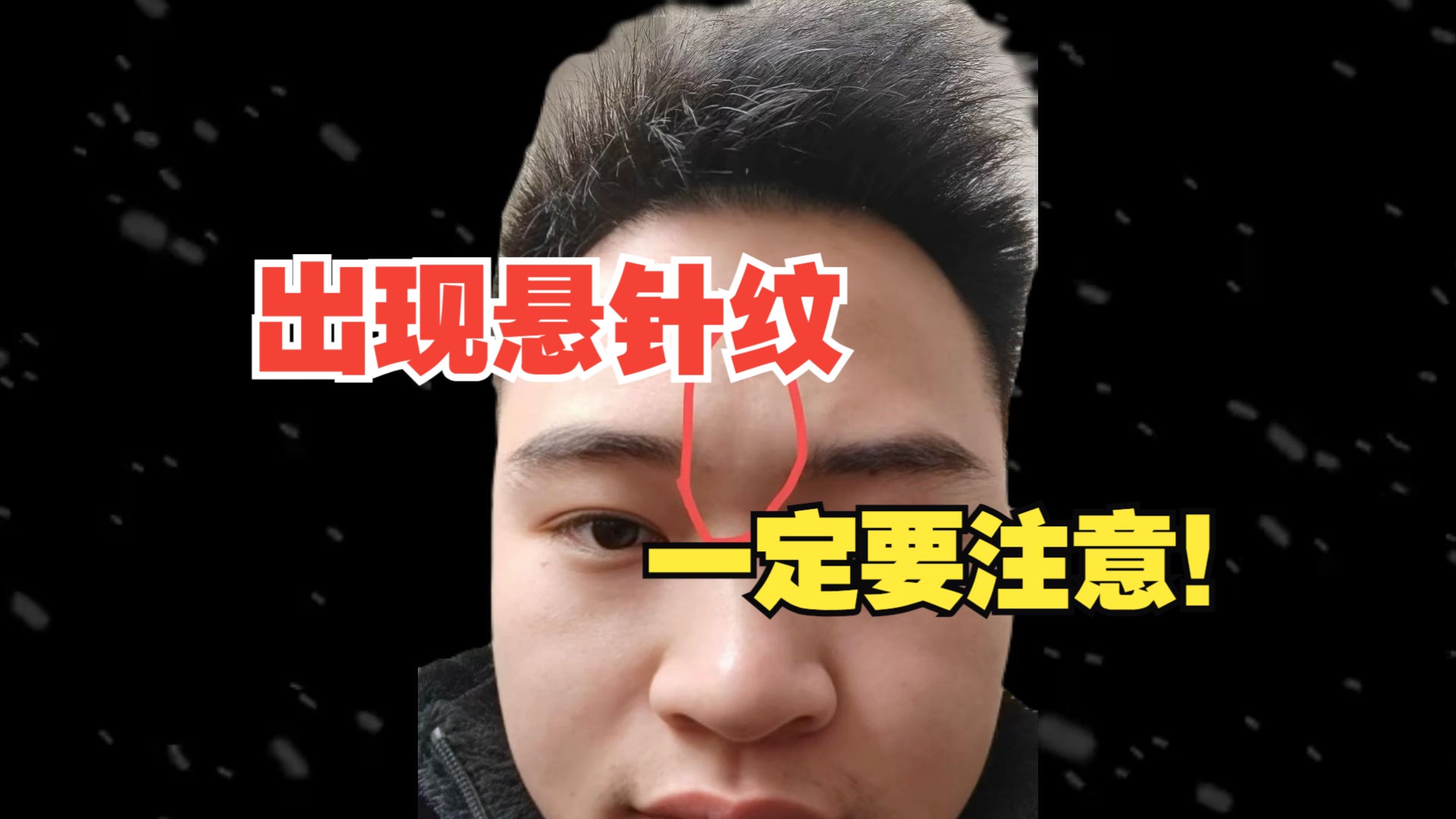 出现悬针纹,一定要注意!